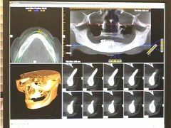 dental ct_image Winterville Denta